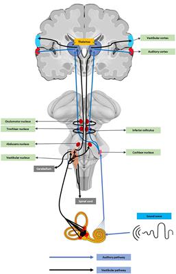 Vestibular Cochlear Manifestations in COVID-19 Cases